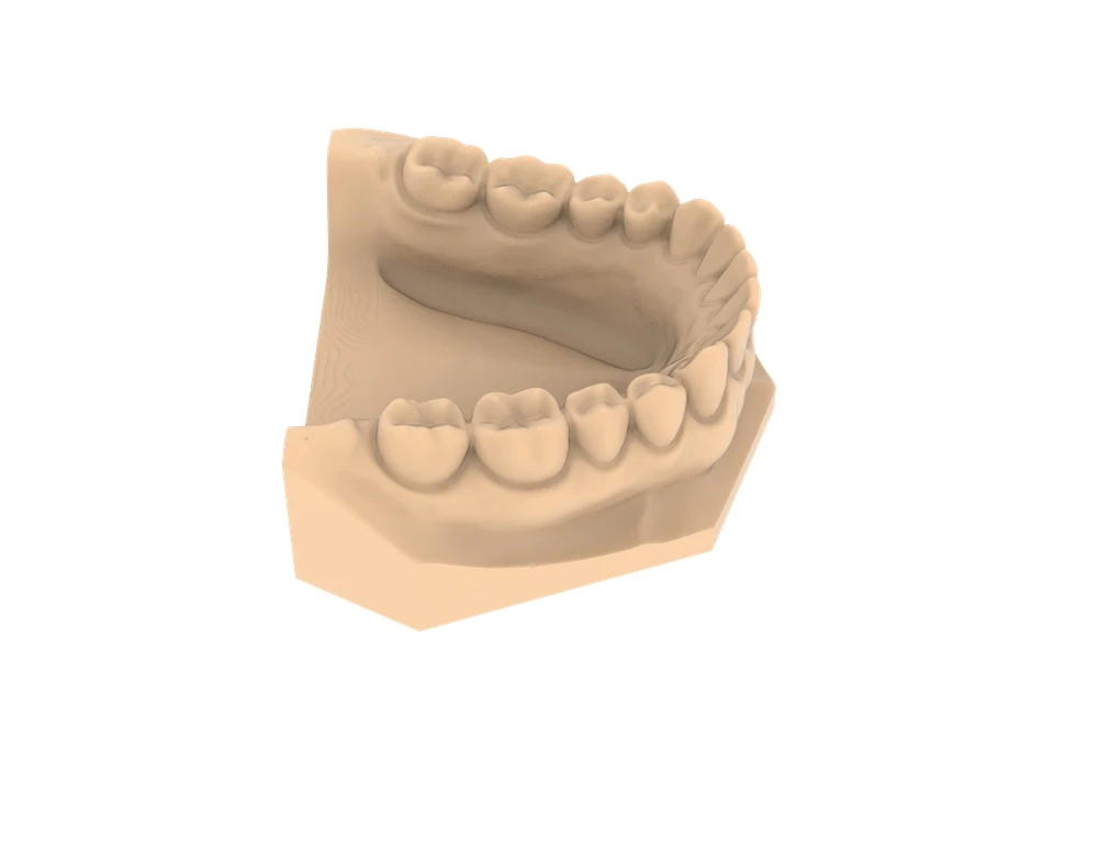 Precision Model Resin Guide 2026: Aniq tiklovchi modellar uchun eng yaxshi yuqori-aniqlikdagi den...